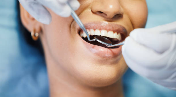 Best Urgent Care for Lost Fillings or Crowns in Central Falls, RI